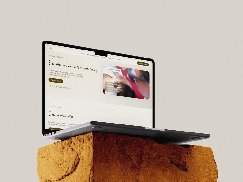 Website van Zera Beauty voor laserbehandelingen en huidverbetering op een laptop